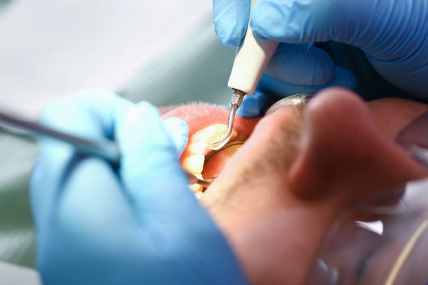 Best Pediatric Emergency Dentist in Sour Lake, TX